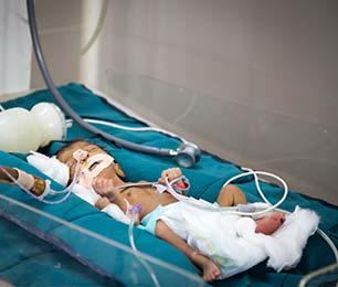 Shrimad Rajchandra Neonatal Intensive Care Unit (NICU)